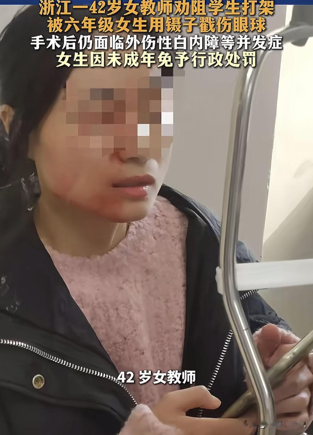 “痛心又愤怒！”浙江瑞安，一名女老师被学生用金属镊子猛戳右眼，致视力严重受损，因