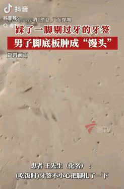 悲剧还是发生了！广东深圳，一男子饭后用牙签剔牙，之后顺手把牙签一扔，一个没注意就