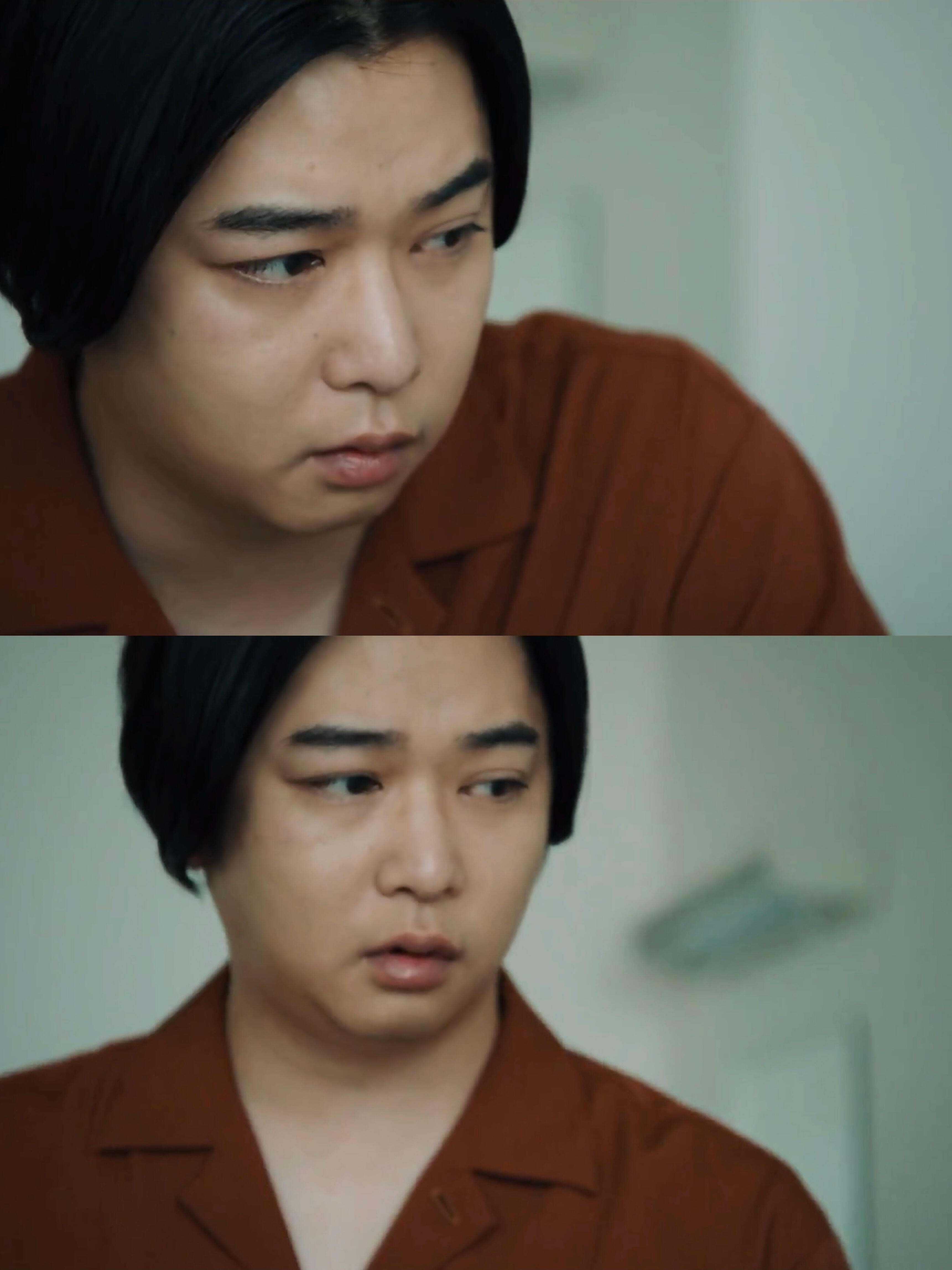 千叶雄大肿么了 ​ 啊？？？？？？？？？？ ​​​