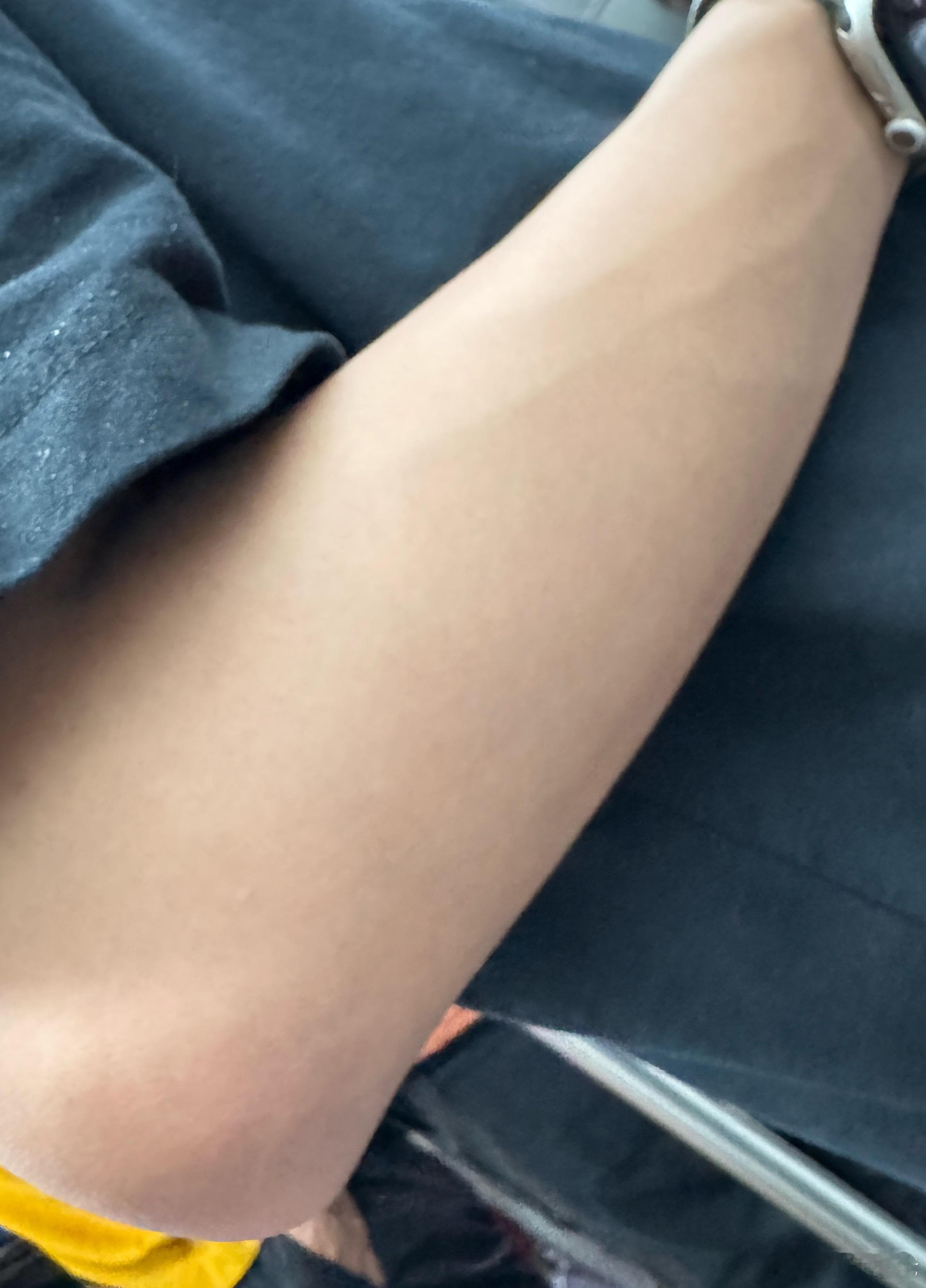 冬天捂白的皮肤，夏天几天就能晒黑，尤其我不喜欢打伞涂防晒[笑cry][笑cry]