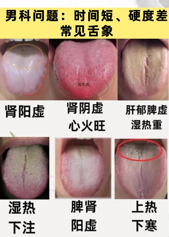 丈夫有心无力，永远无法尽兴，以下六种肾虚问题，自测一下你是哪一种？

今天我会专