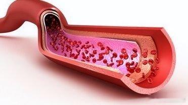 凤凰新闻【再这样睡觉，血管就快“堵死”了，提醒：老人睡觉这3点一定要牢记】这话听