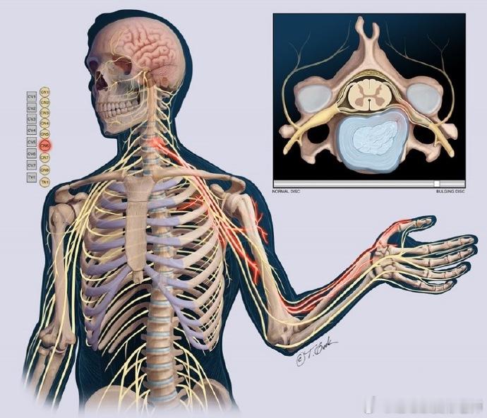 手腕疼痛盘点  前几天发了手腕疼痛盘点的视频，今天再来做一个补充科普之前视频里提