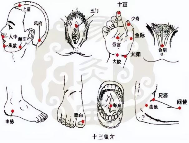 传闻老中医能拿鬼门十三针驱魔化邪。听着像鬼故事对吧？可这套针法，是有实锤文献记载
