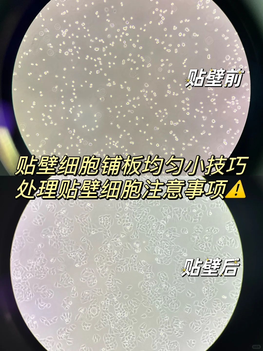贴壁细胞铺板均匀小技巧❗️（研究生进