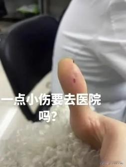 比抢钱还快！陕西西安，女子吃火锅时，筷子上的毛刺扎到拇指，火锅店老板陪女子就医，