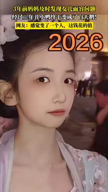 3年前妈妈及时发现女儿面容问题，经过三年丑小鸭终于变成了白天鹅。
网友：感觉变了