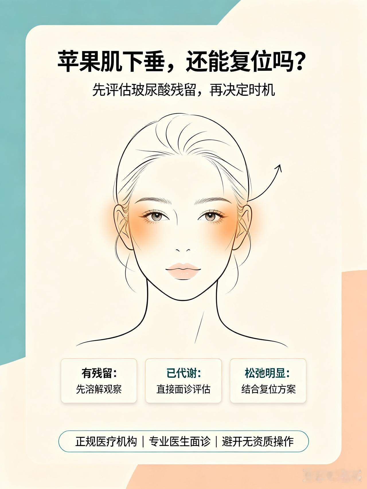 玻尿酸填苹果肌后脸垂，还能做复位手术吗？答案可能让你意外，但前提是选对方法
 
