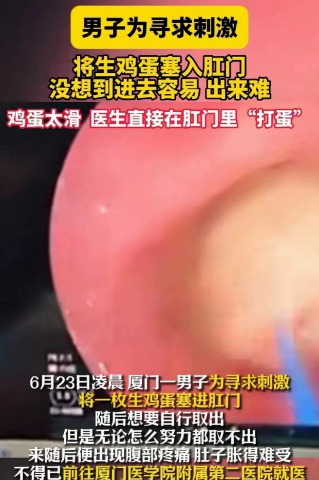 生鸡蛋🥚 ​​​