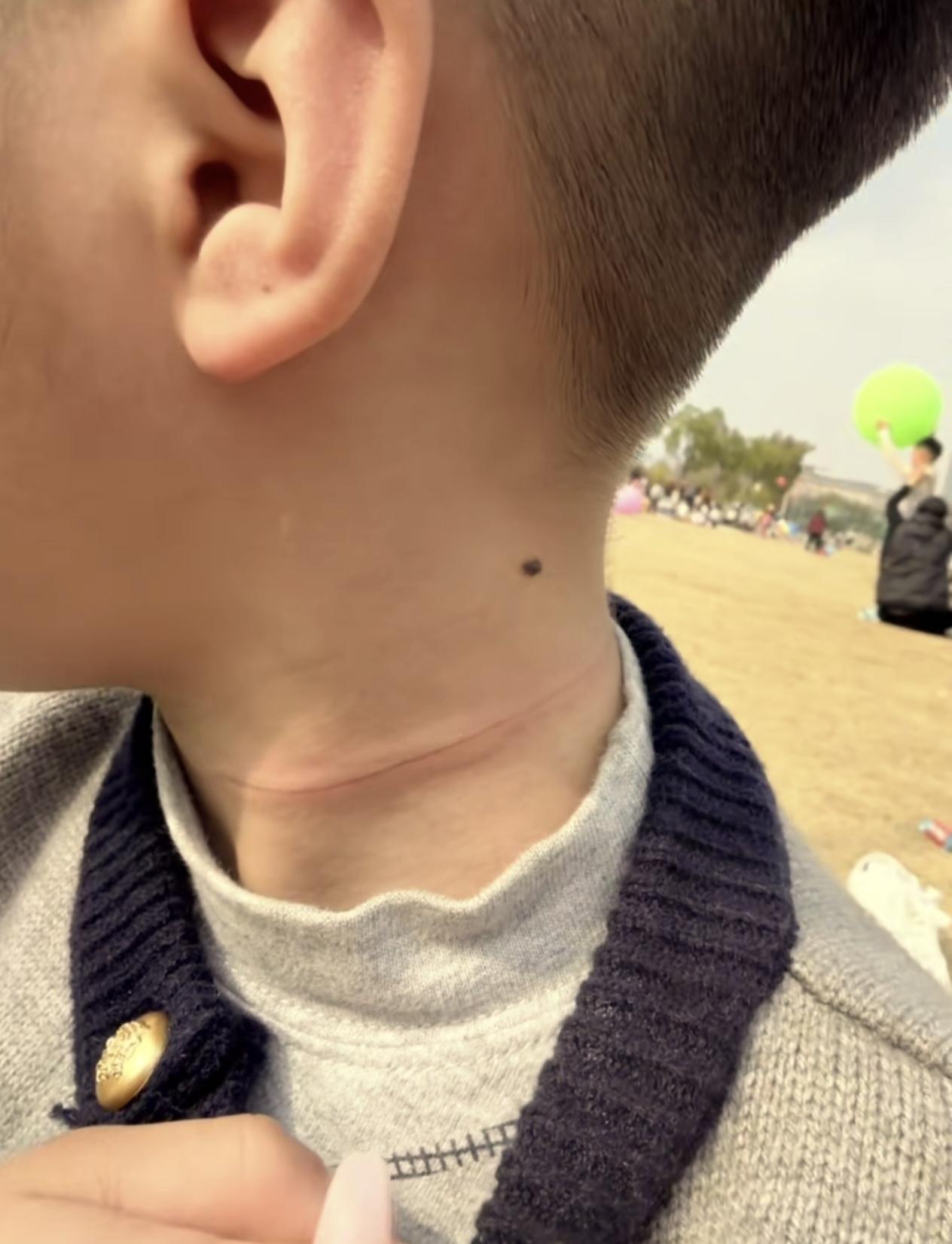 草坪上的风筝线竟然有这么大的隐患。

小朋友在草地上奔跑，没想到撞上放风筝的线，