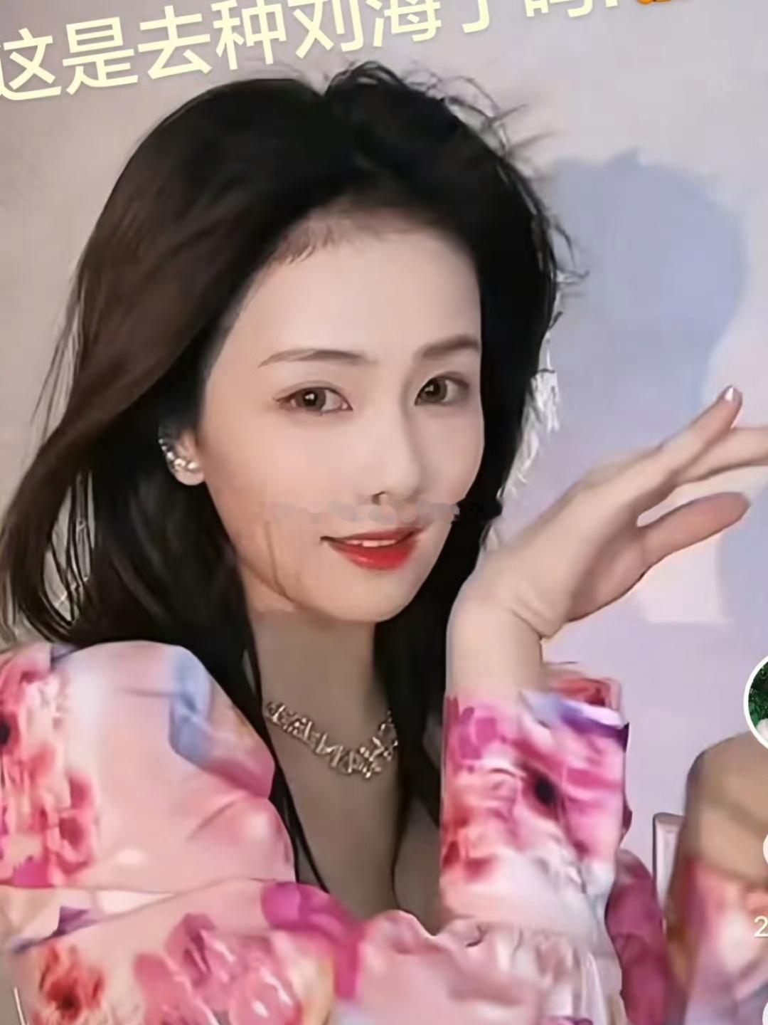 白鹿应该是植过发际线吧，早期这大脑门真的太突兀了…… 