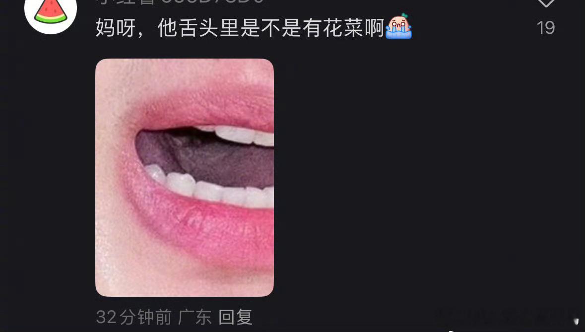 金秀贤舌头上有花菜 有网友质疑金秀贤嘴巴里面有花菜！！网友质疑金秀贤嘴里有菜花 