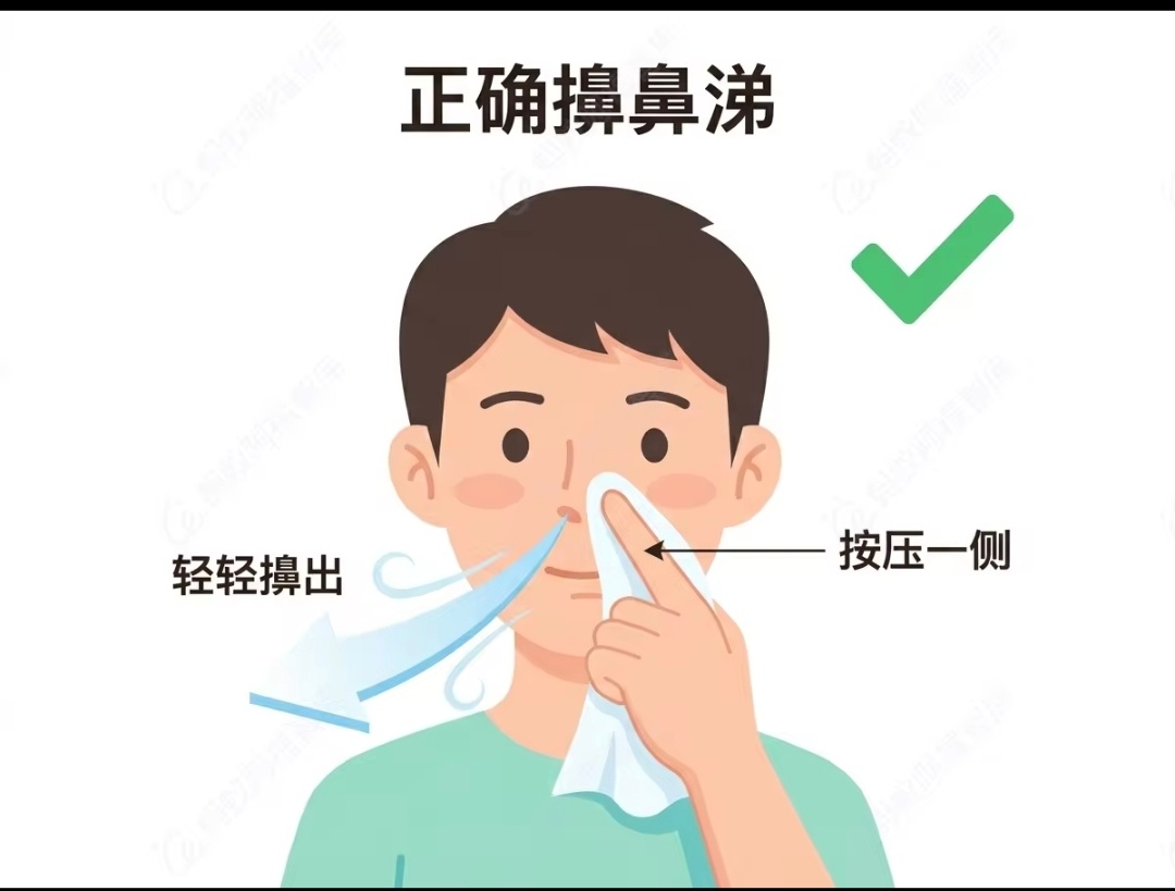 那么多年的擤鼻涕习惯，居然一直是错的感冒换季、鼻炎发作时，擤鼻涕是人人都要做的小