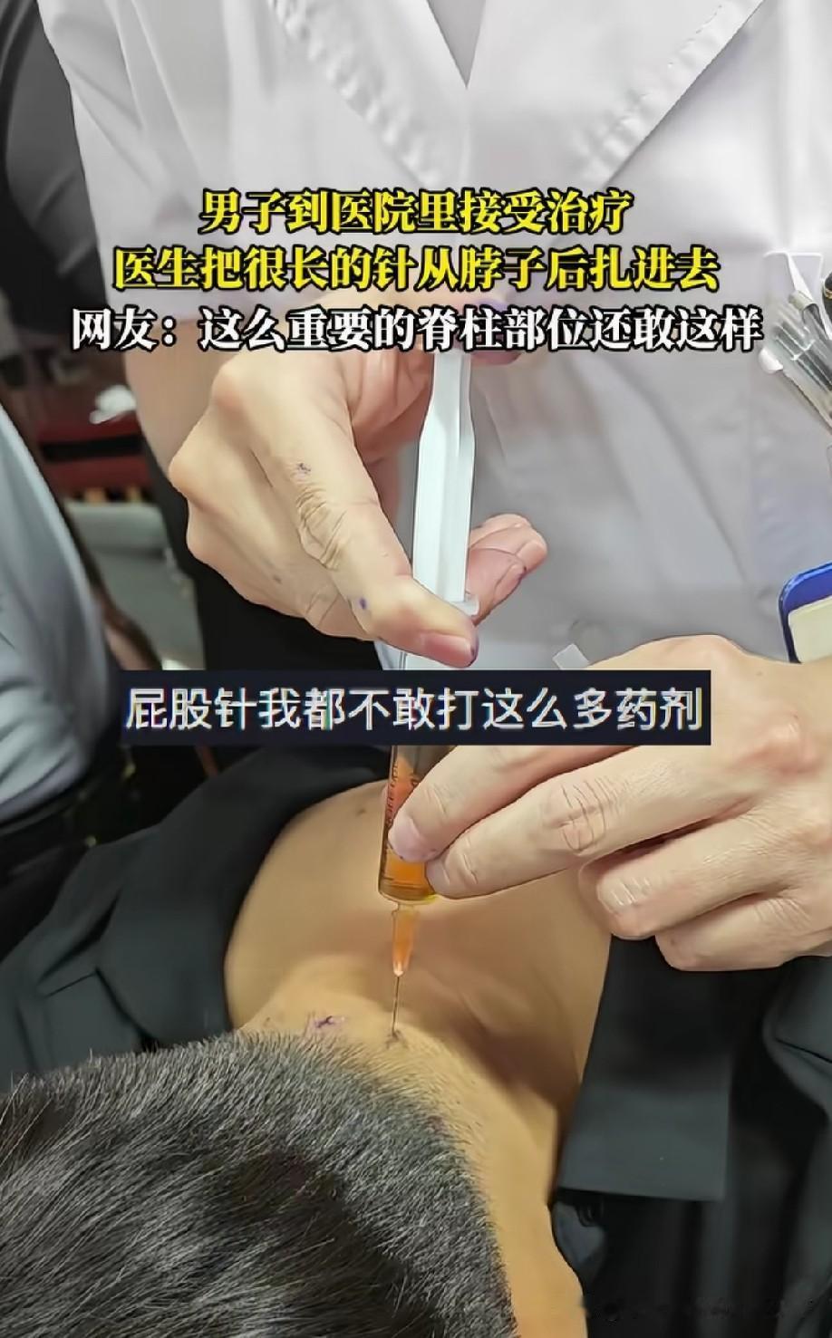 这样真的安全吗[捂脸]那么长得针，让人心惊肉跳的[捂脸]