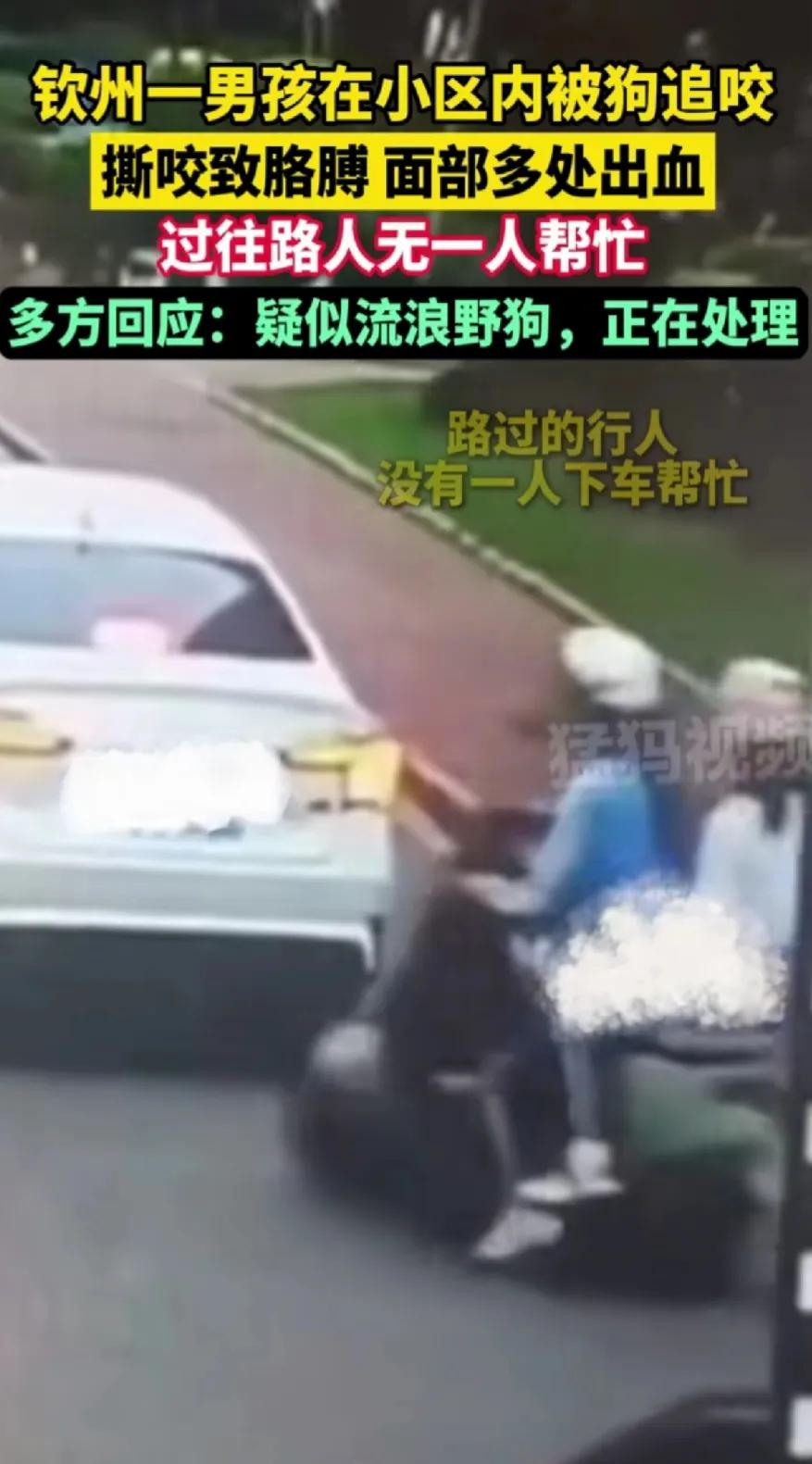 钦州男孩被狗咬，路人无一帮忙。是怕狗太厉害打不过吗？还是担心其他的什么？