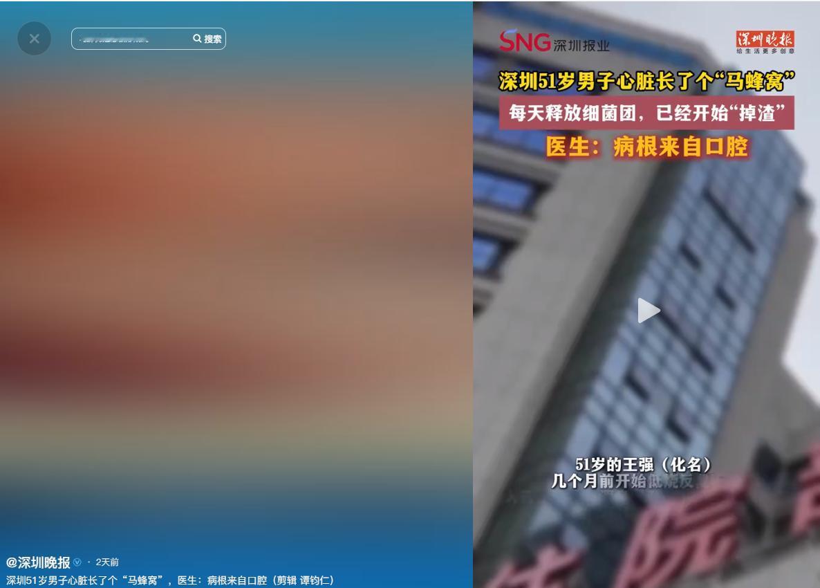 惊魂未定！5月12号深圳晚报，广东深圳一名51岁男子，数月前突然出现低烧不止、浑