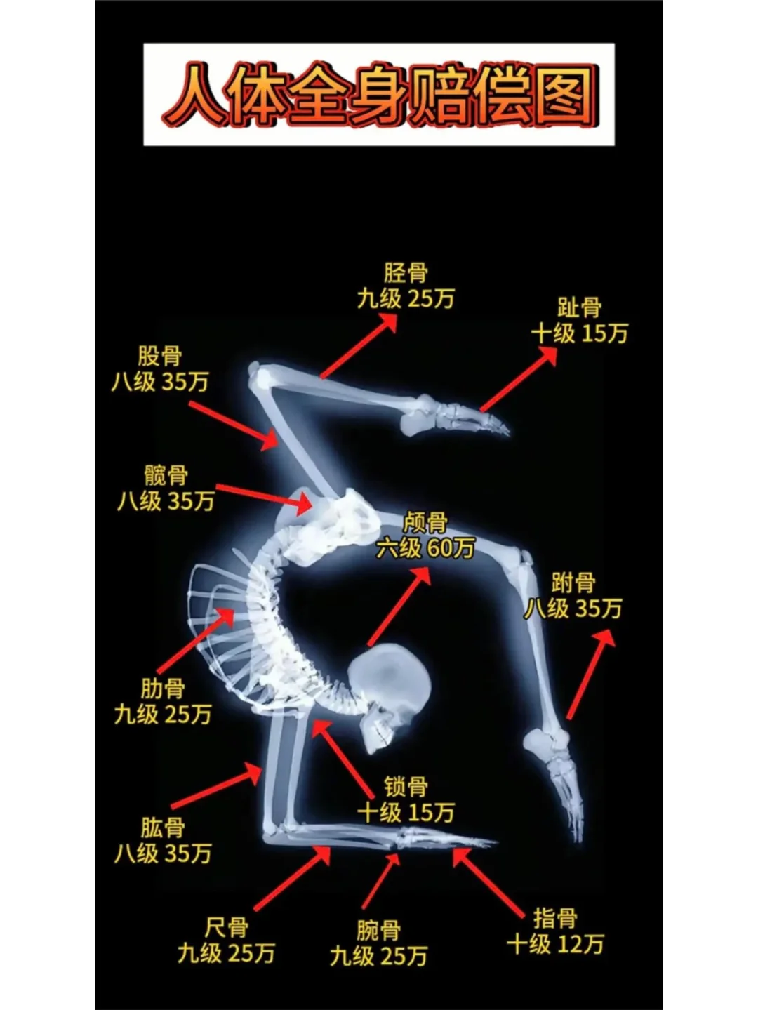 工伤怎么赔？看图