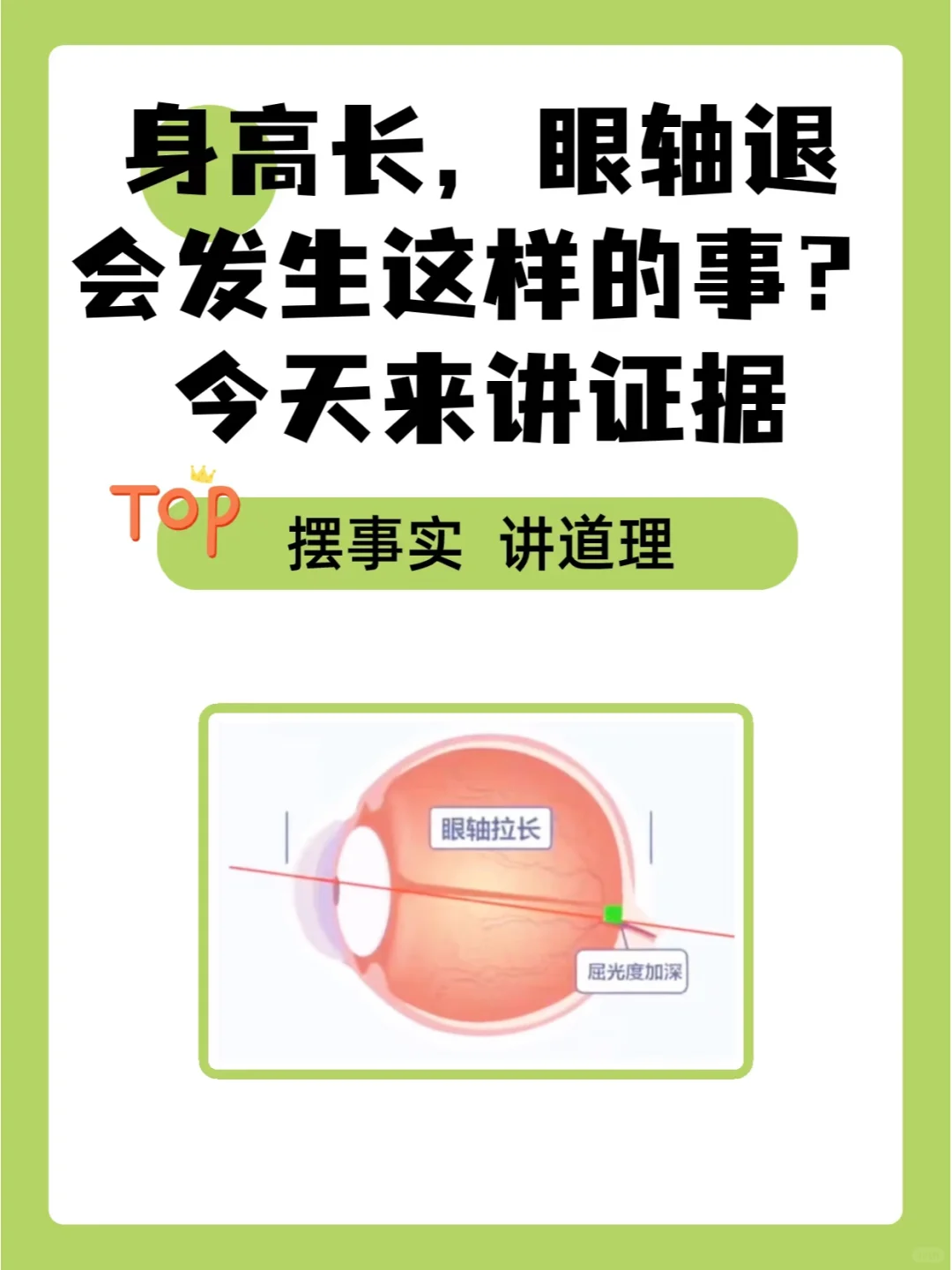 身高长眼轴退，会发生这样的事?今天讲证据