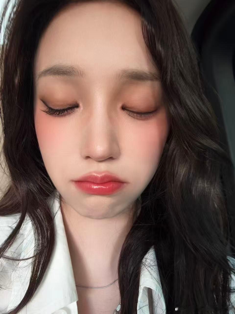 宋雨琦麦粒肿宋雨琦眼睛麦粒肿！宋雨琦眼睛麦粒肿 ​​​