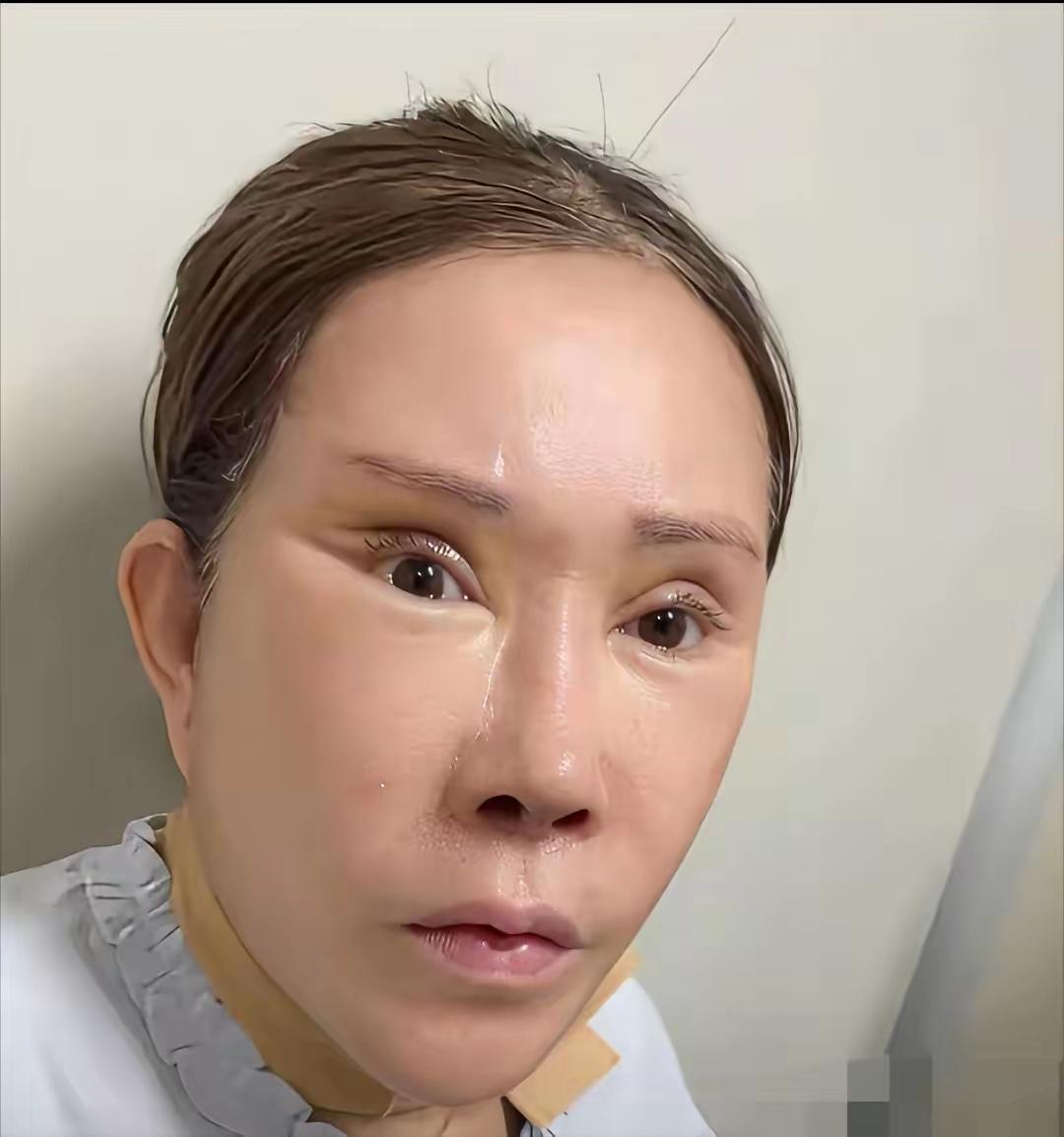 这是一张60岁老太太整容后的照片，确实看起来年轻了一点，但是一点都不自然，总是感