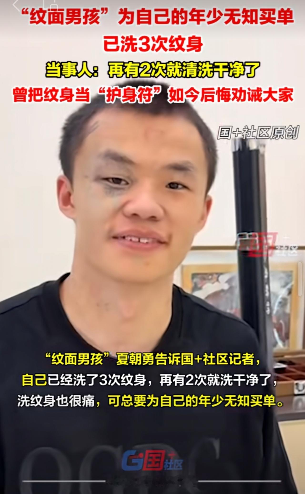 10月10日，“纹面男孩”洗纹赎“年少错”：已经洗了3次纹身，再有2次就洗干净了