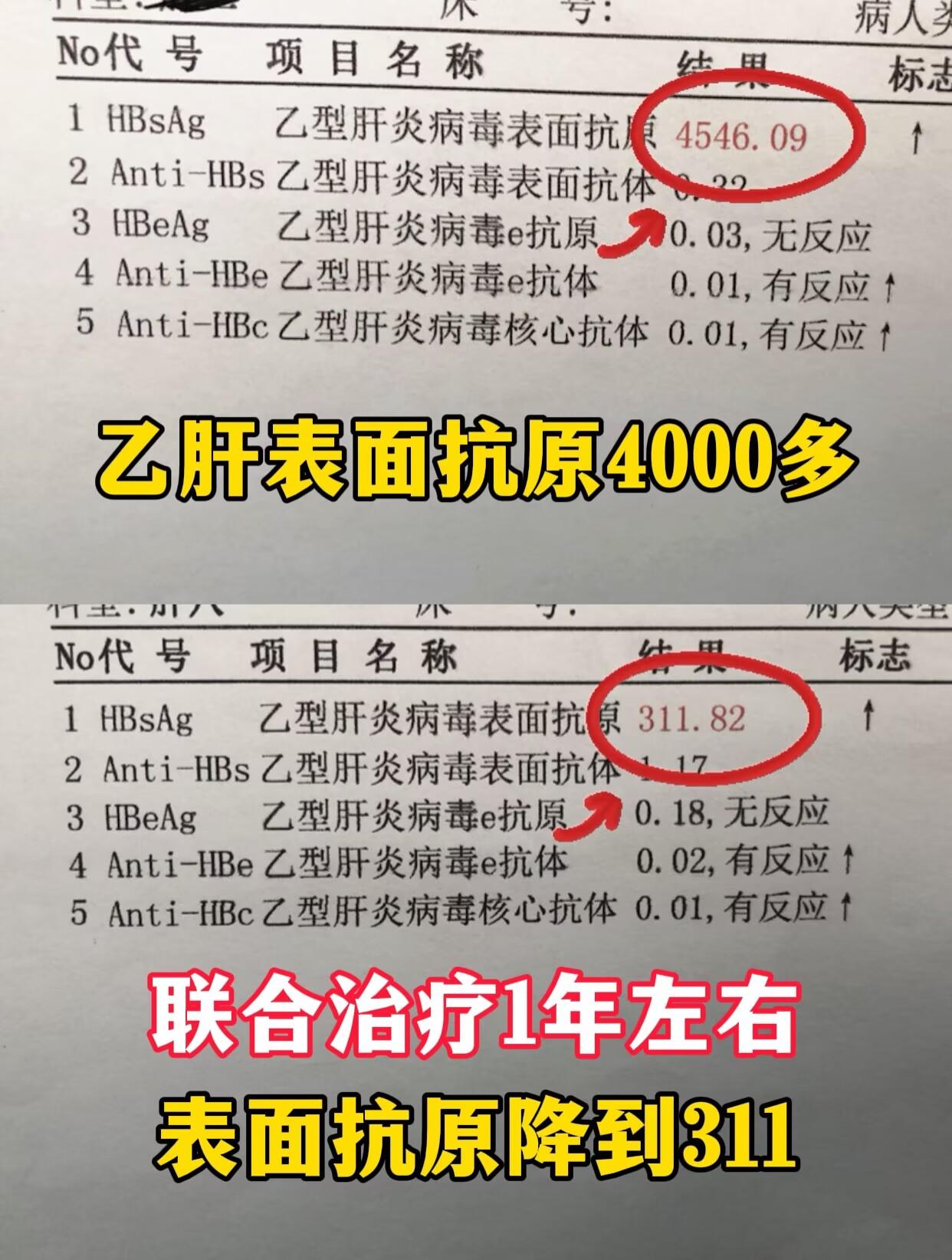 门诊上，31岁的小李从山东德州赶过来，一进门就说：“教授，我就想转阴！...
