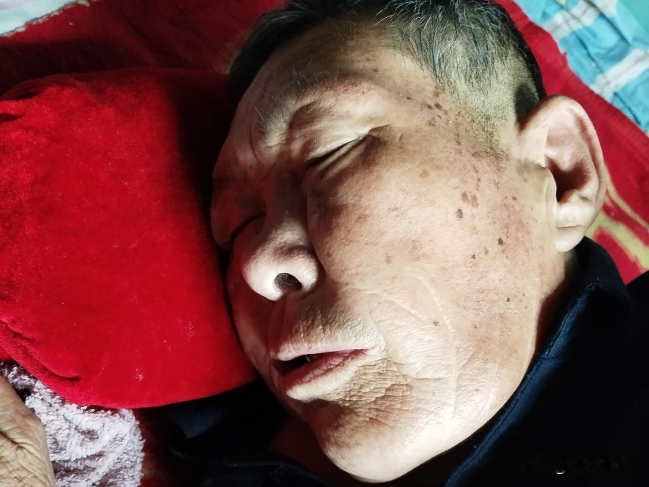 大哥，坐在轮椅上被儿女们推来推去，排队做检查。折磨了两三天，诊断书出来，癌细胞已