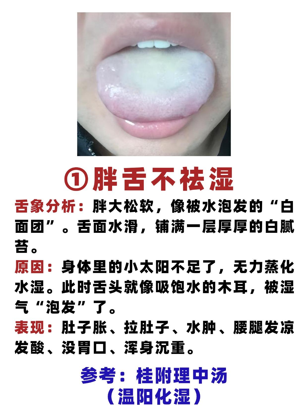 调脾秘诀就一句！中医警告：胖舌别祛湿！瘦舌别清火！齿痕舌别乱攻！