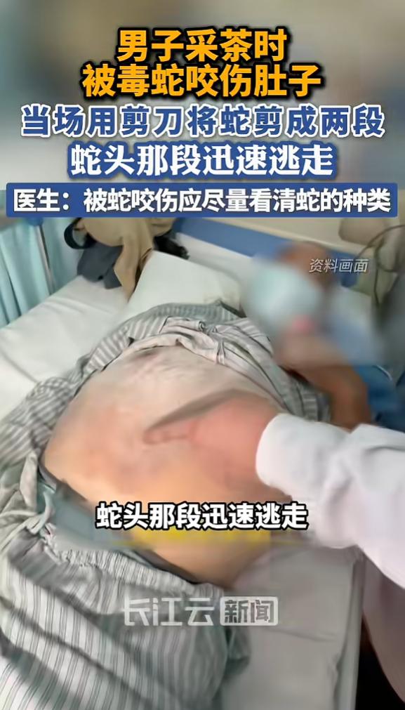 “是个狠人！”7月8日报道，广东，一男子采茶时，碰见了毒蛇竹叶青，还被咬到了肚子