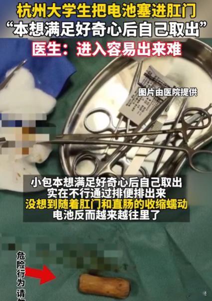 “艺高人胆大！”杭州，一名在校大学生，突发奇想把一节5号电池，塞入到自己的后庭，