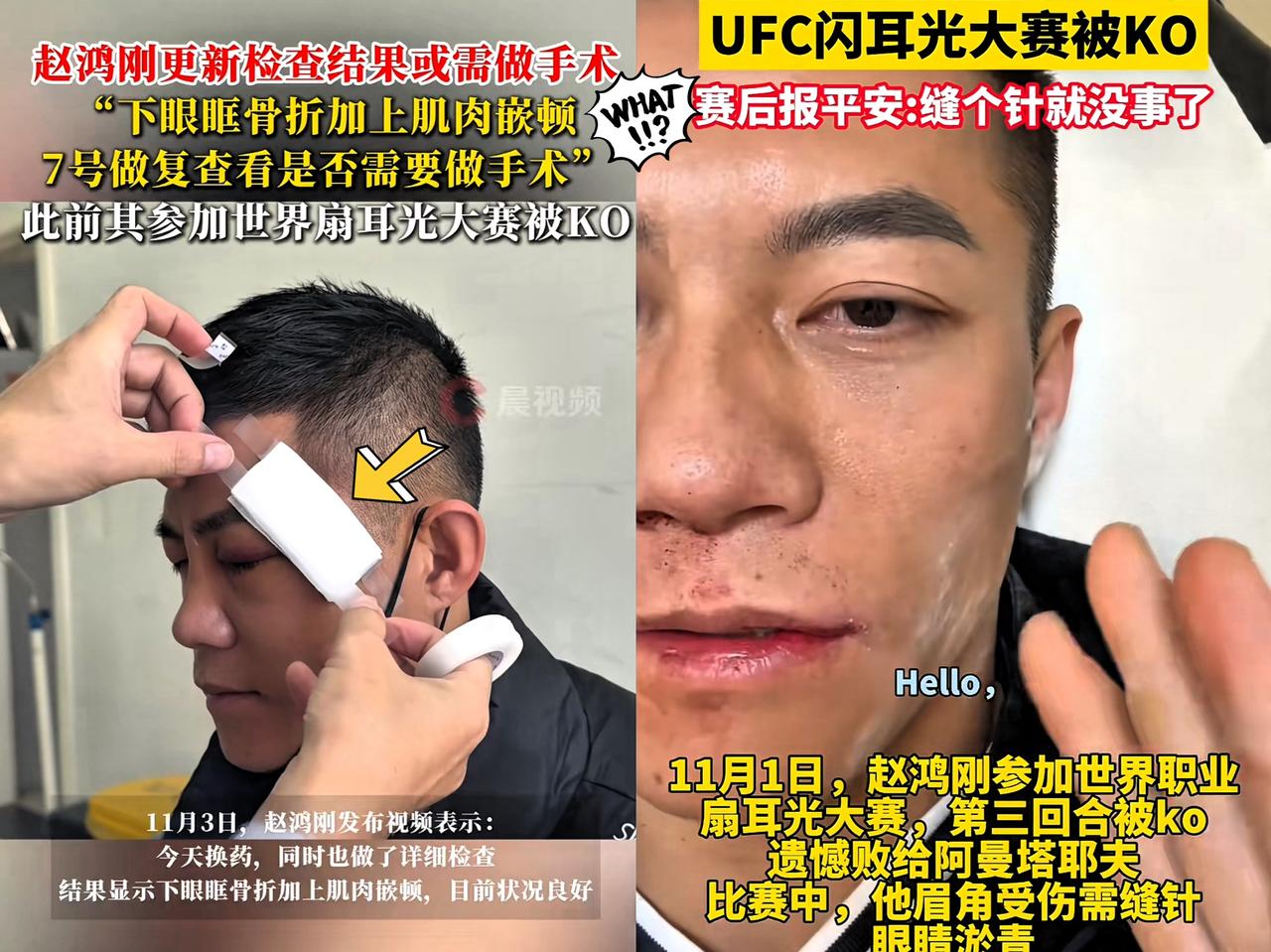 脸刚挨完巴掌，赵洪刚就笑了。

他笑，是因为终于摸到门道：原来

这耳光赛不许躲