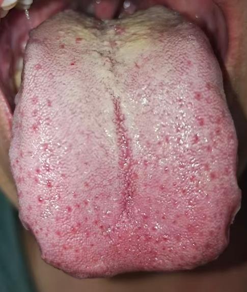 正视男性常见健康问题，科学调理不盲目






很多朋友年少无知染上了手瘾的坏