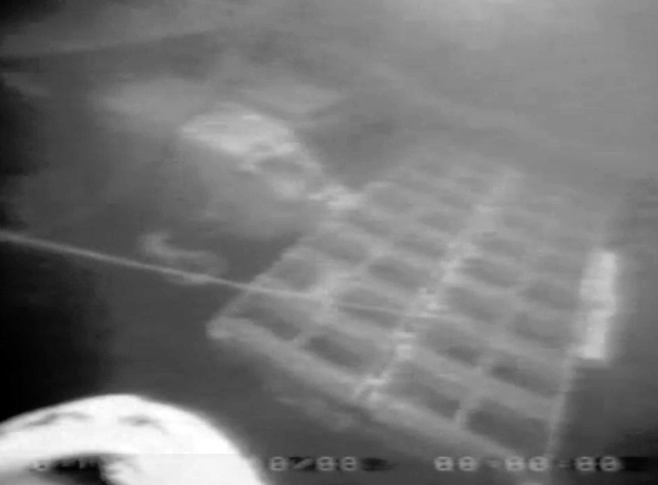 “黑腿行动”（Operation Blackleg，1982 年 9 月 16 