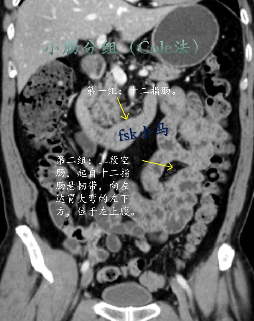 小肠X线分6组（Cole法）：第一组为十二指肠；第二组为上段空肠，起自...