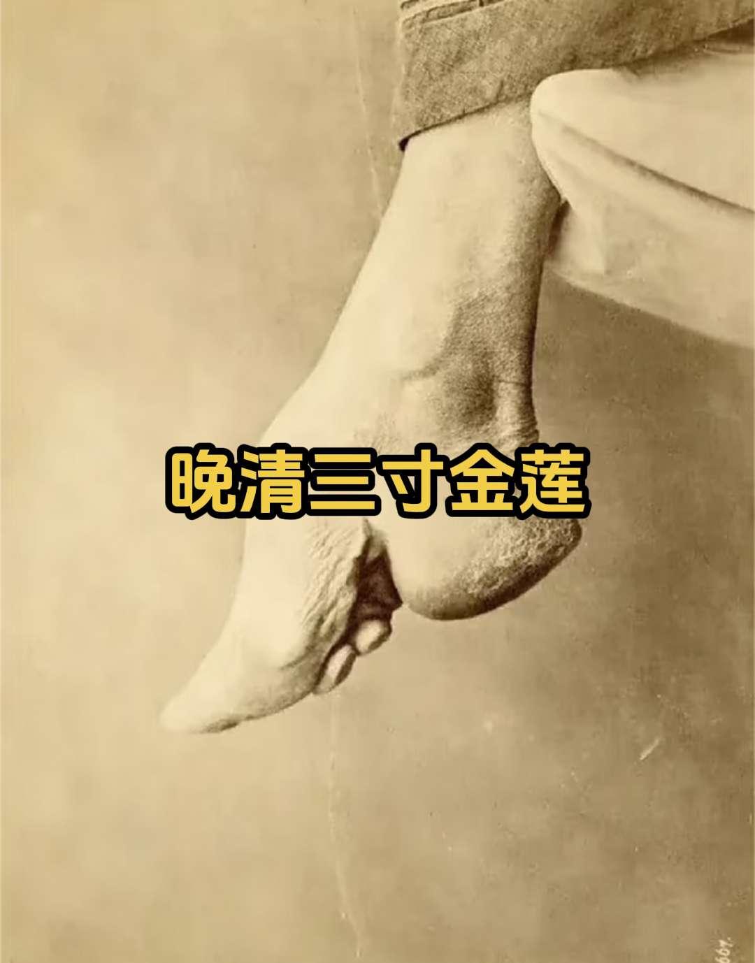 晚清旧照 三寸金莲 。缠足（裹足、裹脚）是中国古代的一种陋习，就是把女...