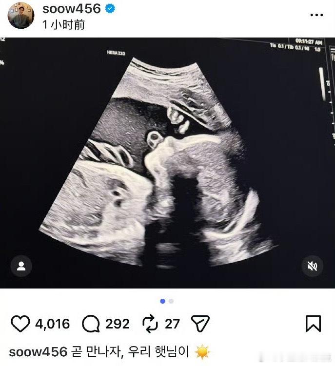 A微博娱乐宋承炫宣布得子 10日，前FTISLAND成员宋承炫发文宣布儿子出生，
