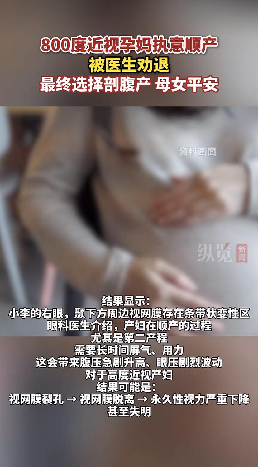 31岁的小李近视800多度，但她一直想顺产。从怀孕开始，她就奔着这个目标去，产检