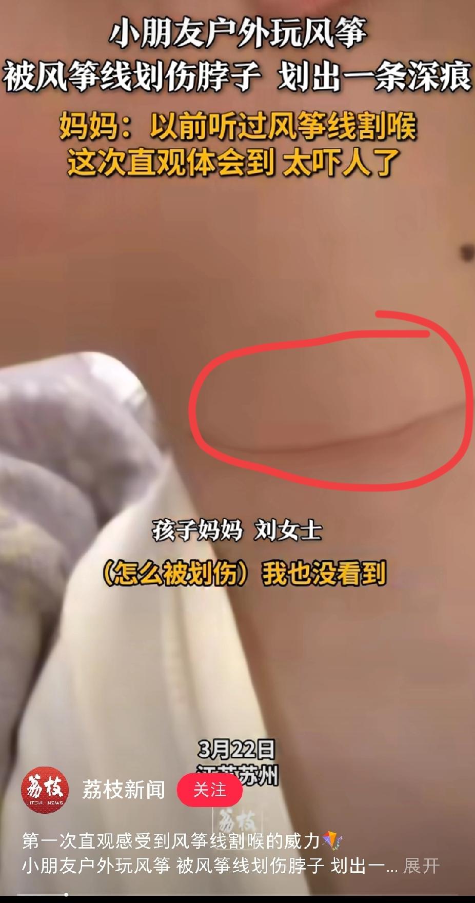 终于理解
为什么香港很多地方不给放风筝，原因很简单，就是因为无论多小的风筝，风筝