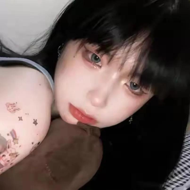 有痘痘没关系，重要的是脸好看痘痘 长痘 痘痘治疗方法 粉刺爆痘 痘痘青春痘 青春