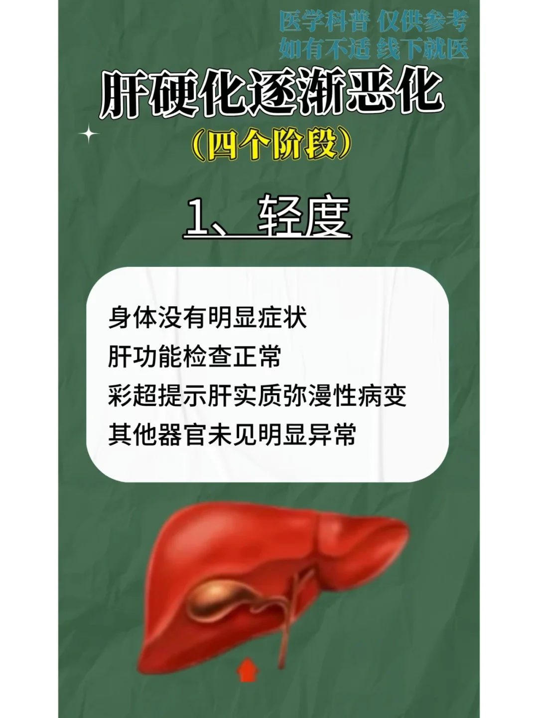 肝硬化逐渐恶化的四个阶段，你知道吗？﻿山东﻿ ﻿乙肝﻿ ﻿健康科普﻿ ﻿