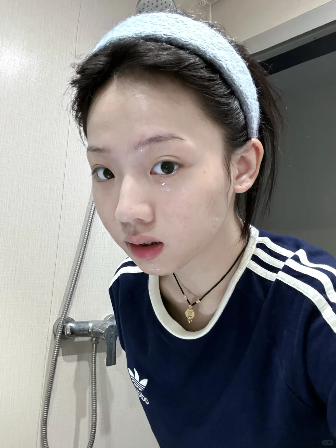 夏天坚持敷芦荟胶结果……
