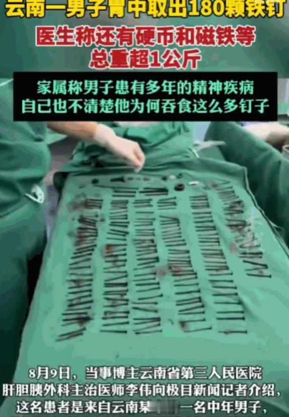 解释不清了！云南，一男子腹部剧痛送医，医生检查后当场被吓退三分：他体内居然塞满了