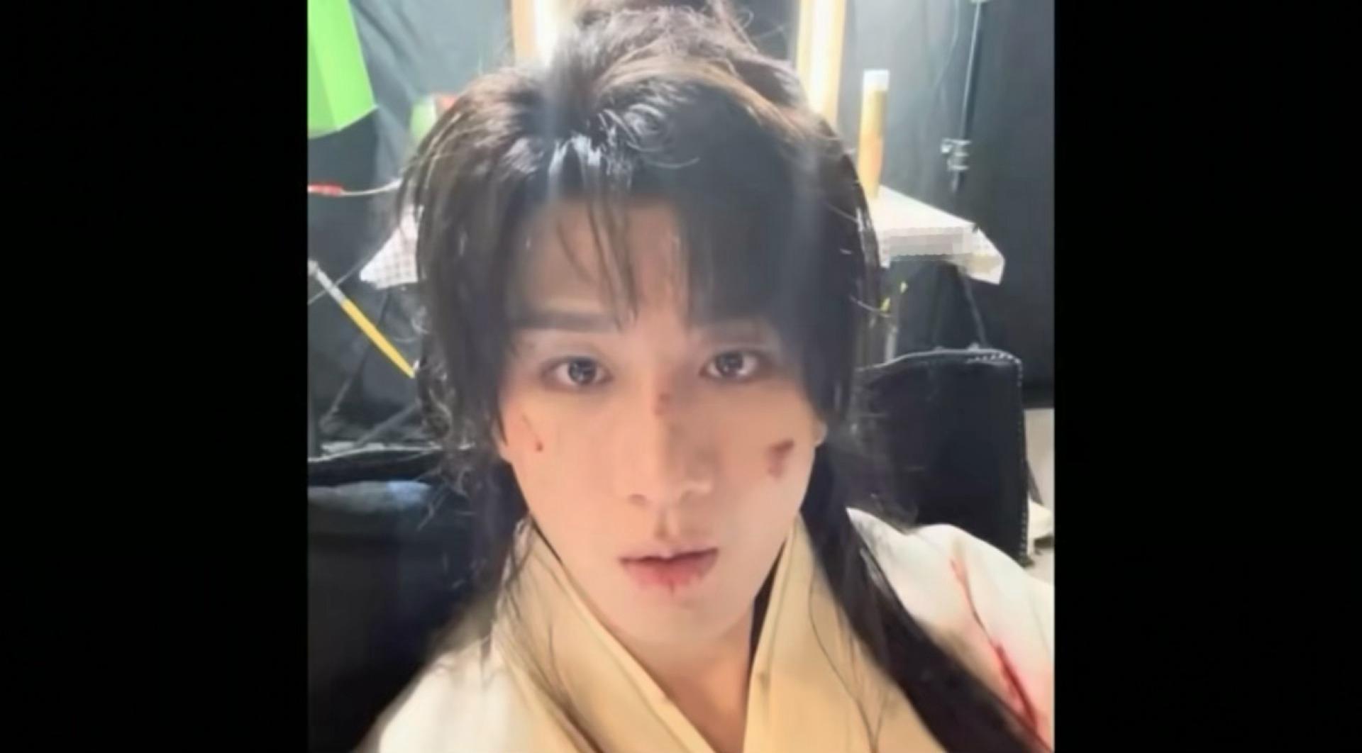 成毅[超话]  总是会格外的偏爱萧秋水，看着就让人心疼成毅 ​​​
