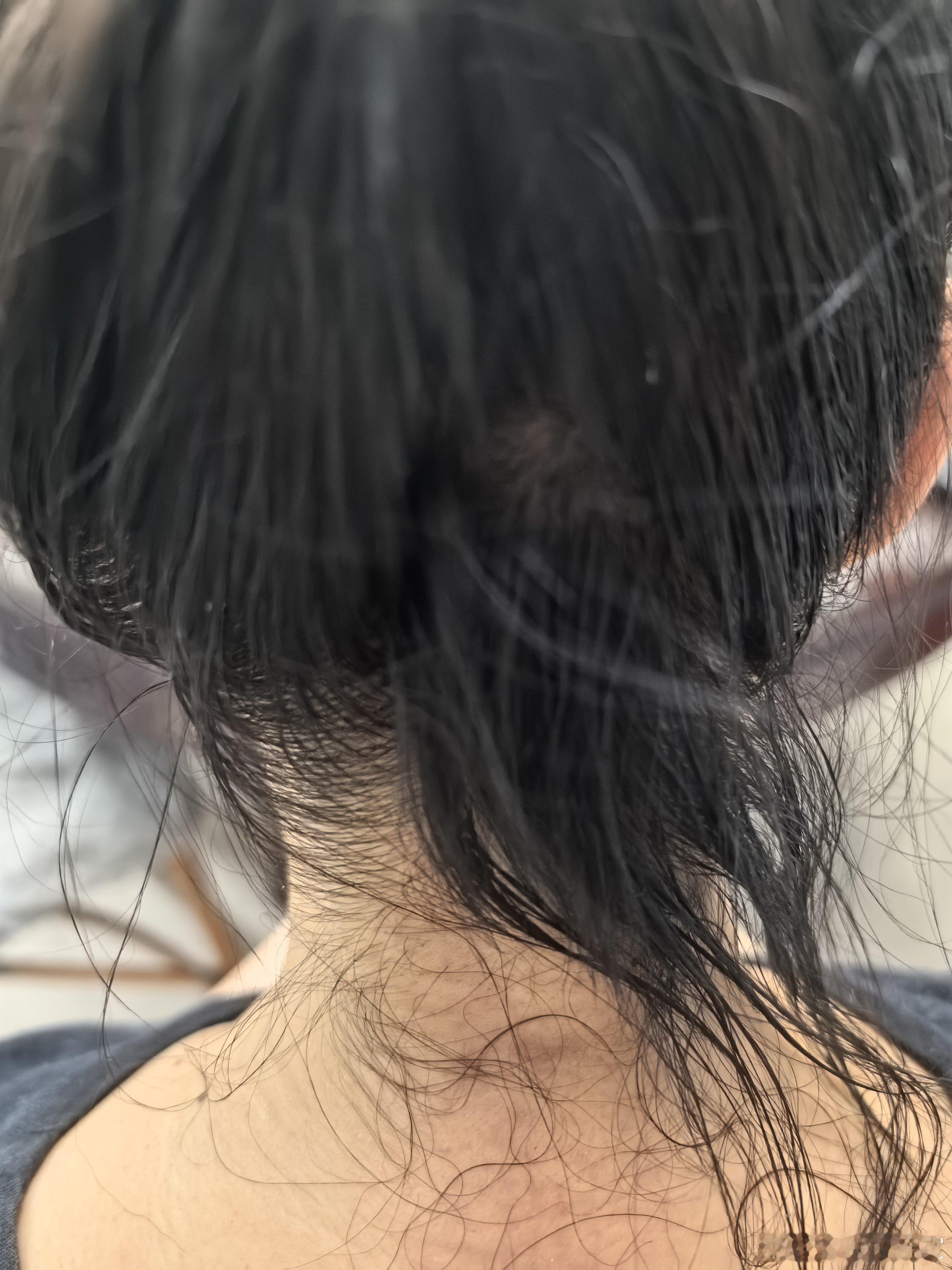 我老婆以前不是掉头发吗？后来持续吃我的补阳药，半年后开始说头发变密变黑了。现在发