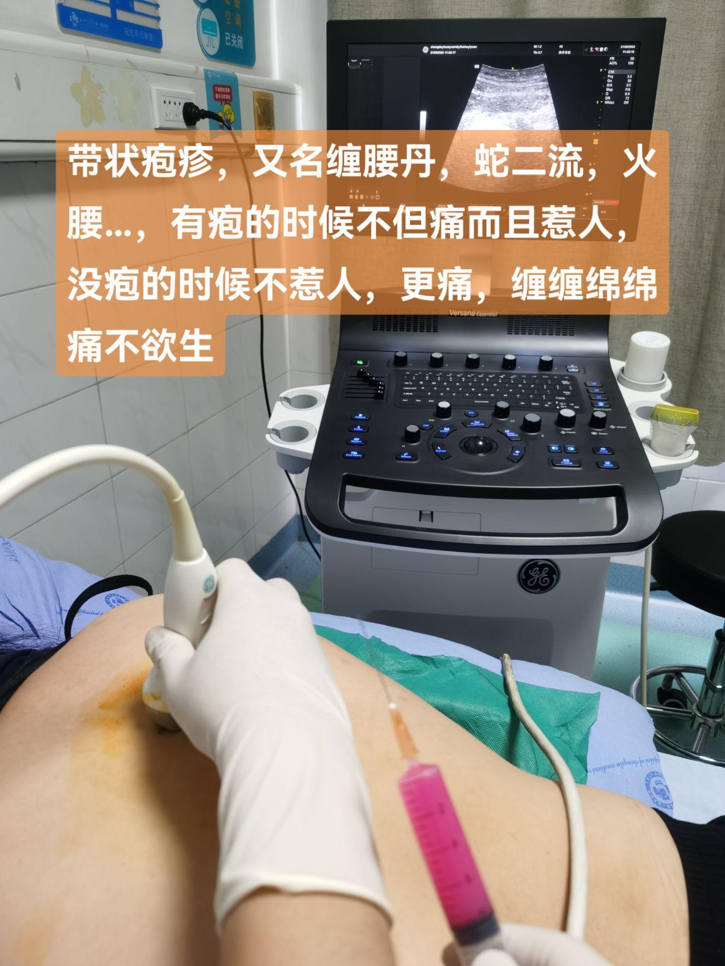 带状疱疹，又名缠腰丹，蛇二流，火腰…，有疱的时候不但痛而且惹人，没疱的...