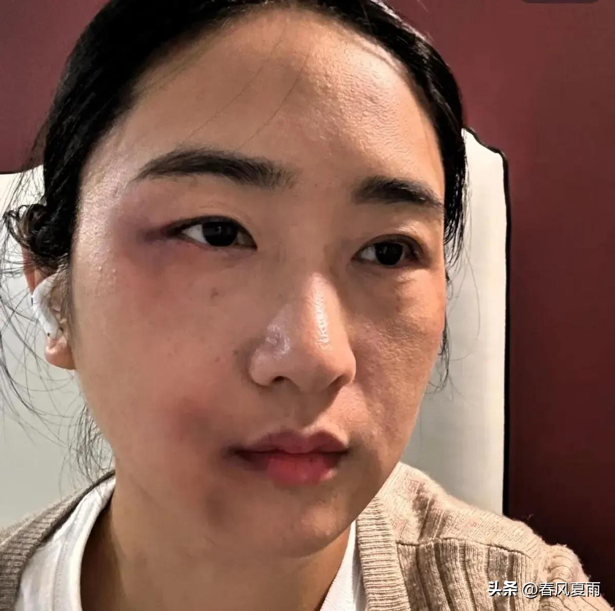 孕36周的准妈妈被丈夫一脚踹在腰侧，没哭没闹，转头去医院开了病历直奔派出所。她说