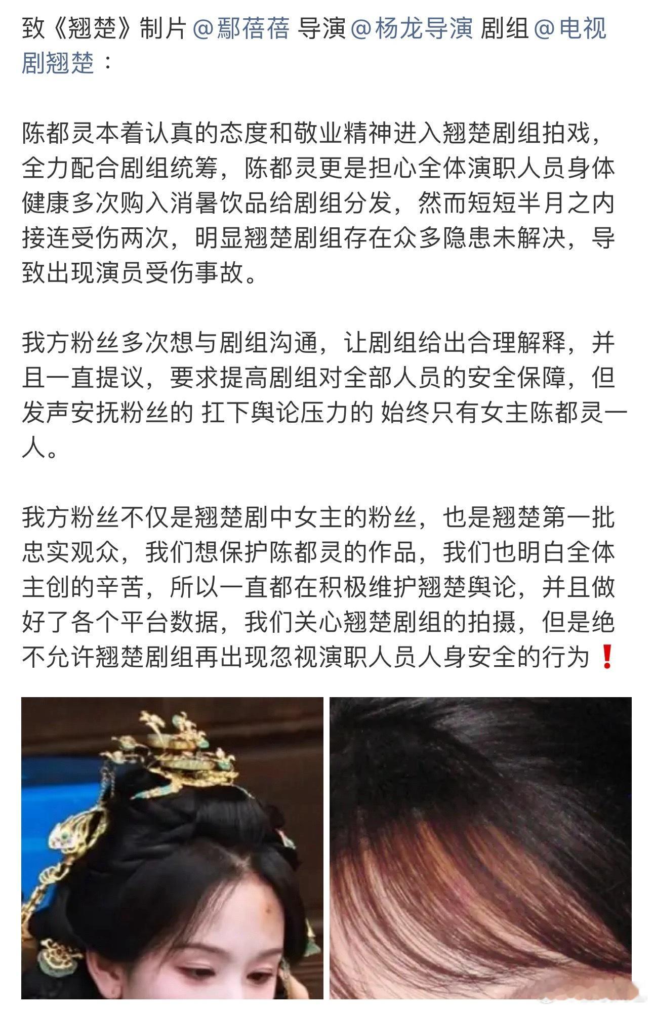 陈都灵额头伤疤看起来好严重 ​​​