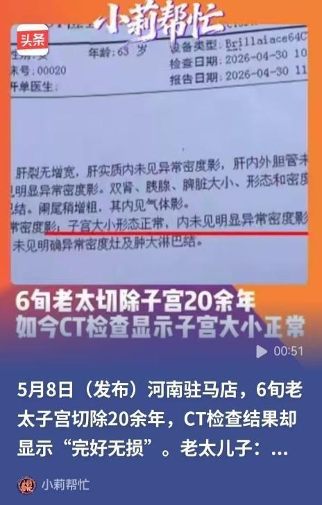 5月8日红星新闻报道，河南驻马店，韩先生带母亲去检查，不料CT报告竟称其“子宫大