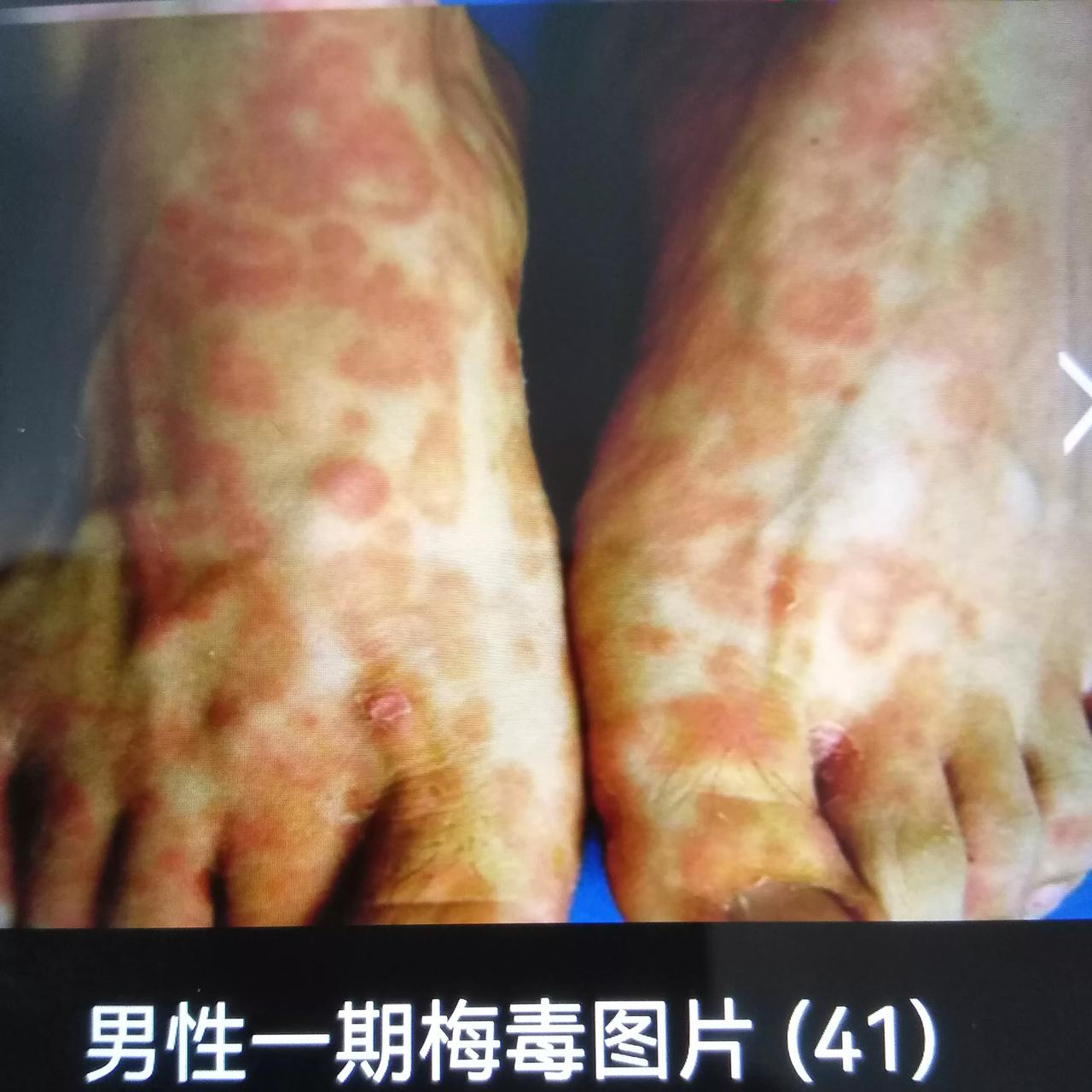 中国所有地方要向沈阳学习把所有传染病向社会公开的！