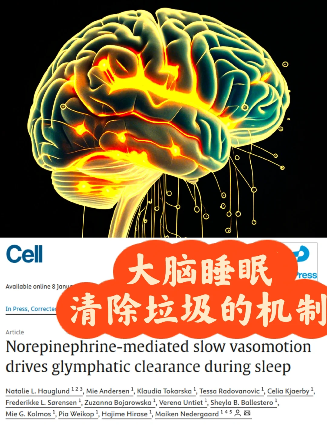 Cell重磅-安眠药扰乱大脑废物清除导致AD